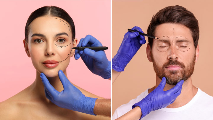 Medicina estetica microneedling